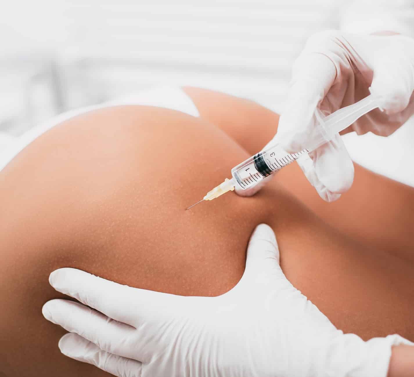 Acide hyaluronique fesses à Gonesse | Acide hyaluronique tarif | Médecine esthétique | Institut R.E.N